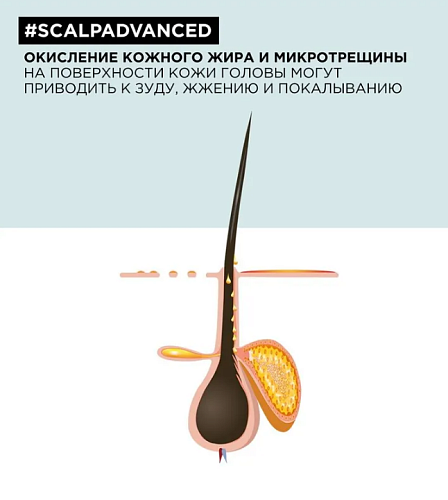 Кондиционер для чувствительной кожи головы Scalp Advanced L'oreal Professional 200 мл